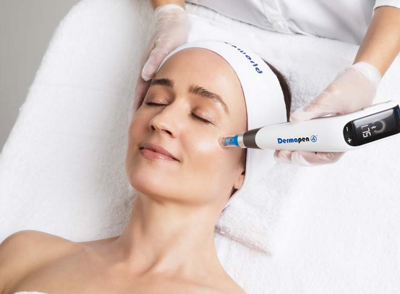 Microneedling Treatment